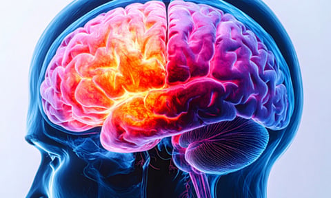 Women with Down syndrome at high risk of Alzheimer's disease (IANS)